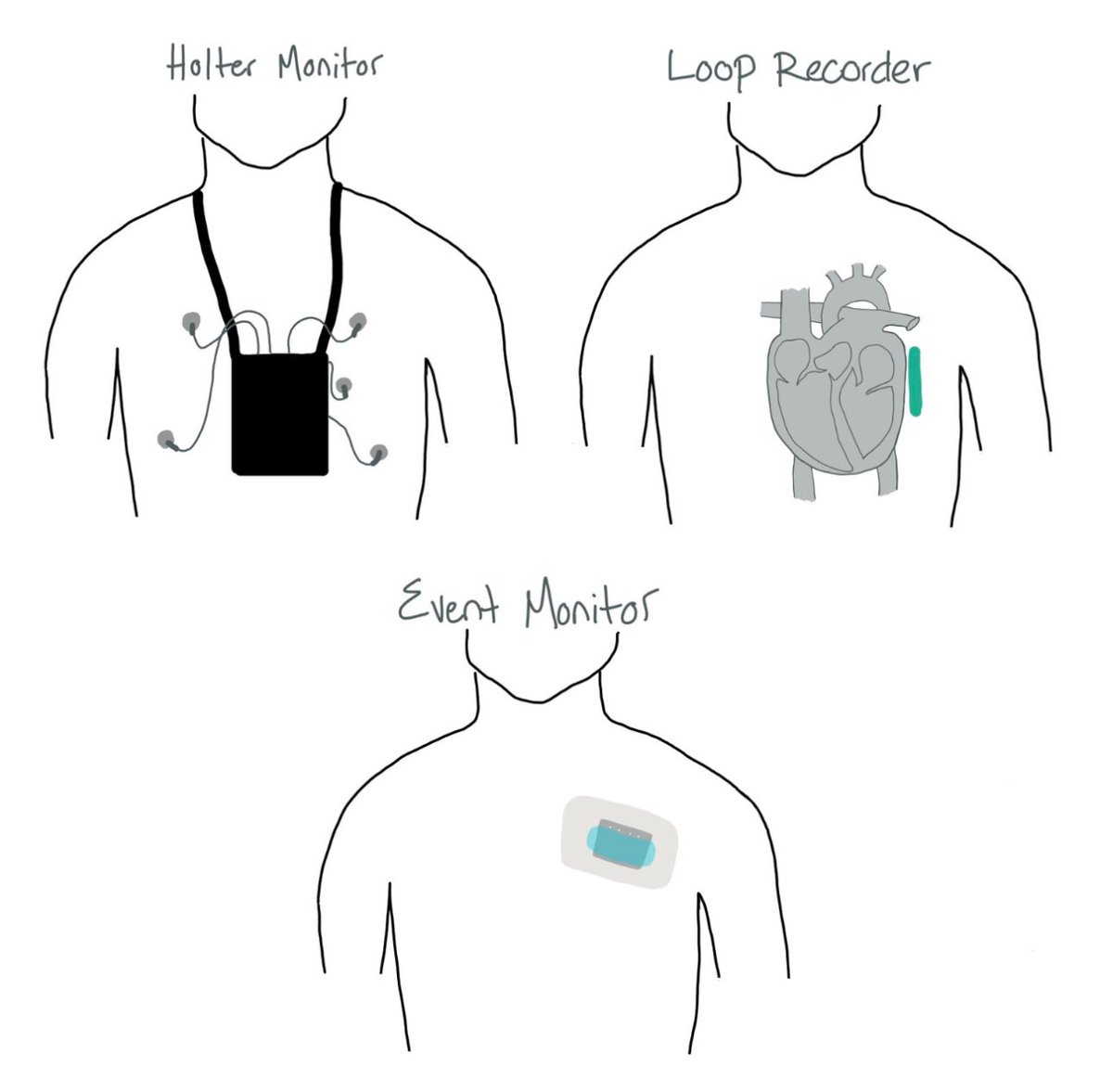 Rebecca Garber (@bexg_md) on Twitter photo New chapter drop! Everything you need to know about bradycardia! Take a pause and learn more here:
whenthebeatdrops.org/content/bradyc…
With <a href="/Collettenonye12/">Nonye Uche</a>, Mark McCauley, and Aamir Twing! New chapter drop! Everything you need to know about bradycardia! Take a pause and learn more here:
whenthebeatdrops.org/content/bradyc…
With <a href="/Collettenonye12/">Nonye Uche</a>, Mark McCauley, and Aamir Twing!