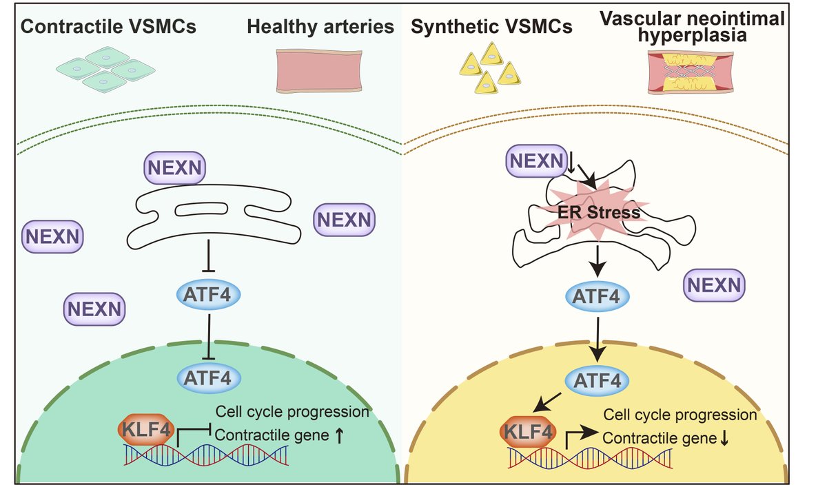 🧪 Scientists demonstrate NEXN is highly expressed in VSMCs, and the expression of NEXN is significantly reduced during the phenotypic transformation of VSMCs and intimal #hyperplasia induced by #VascularInjury. 

<a href="/JCI_insight/">JCI insight</a> | bit.ly/4kBqep6