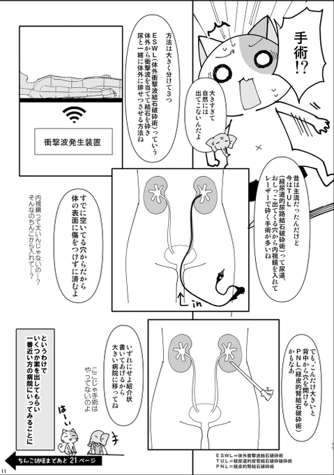 今回体験したのは
2番目の
ち●こから内視鏡を挿入して石をレーザーで破砕し、掴んで取り出すタイプです 