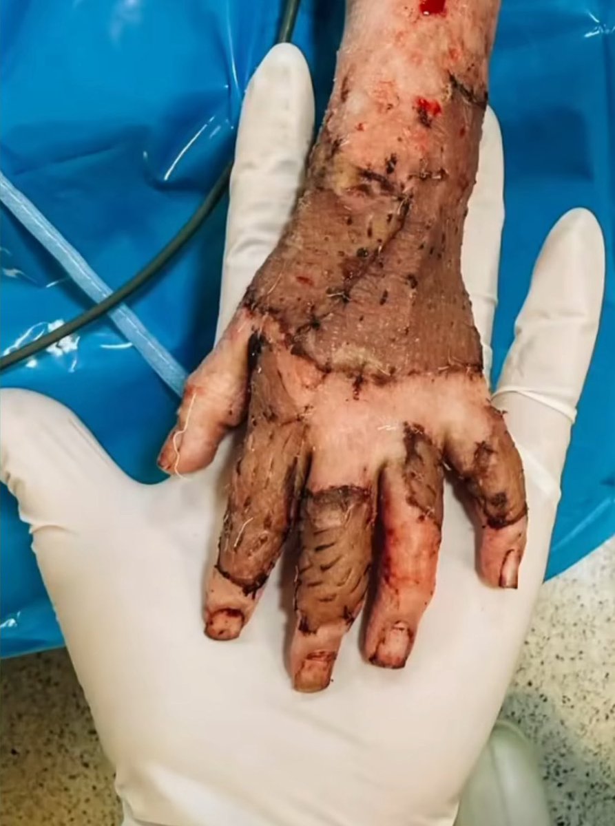 Israhell did this