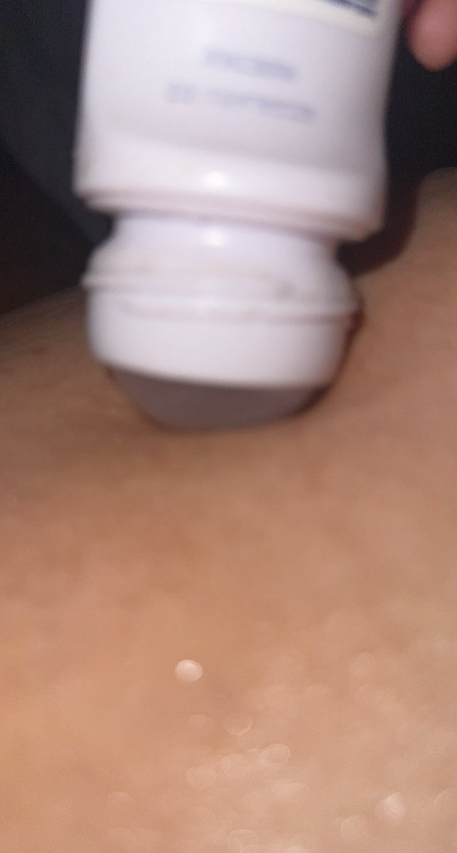 ellenluvs0kalz's tweet photo. needed to put deodorant on my belly button because it’s starting to smell because of anna please any tips i put a Q tip in there and smelled it and it threw me against the wall in shock and i insnalty through up. #help #skinny #spo #anna #bmi2 #deathspo #ana #anaspo #notfatspo https://t.co/BOZ7qpthnJ