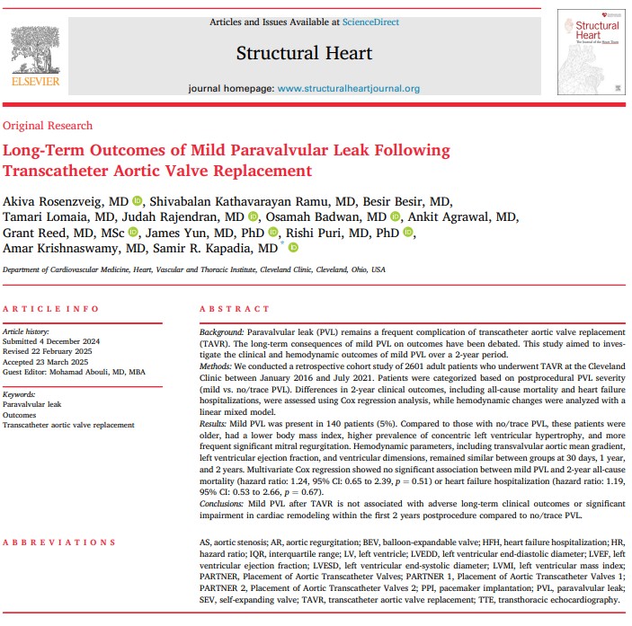 Judah Rajendran (@j_at_judah) on Twitter photo Mild PVL after TAVR? Turns out, a little leak won’t sink the ship.🫀Leaky but lucky—no harm done at 2 years.
Valve may whisper, but it won’t scream. Check our latest paper from <a href="/ClevelandClinic/">Cleveland Clinic</a> <a href="/CleClinicHVTI/">Cleveland Clinic Heart, Vascular & Thoracic</a> under <a href="/tavrkapadia/">Samir Kapadia</a> by 🌟 <a href="/AkivaRosenzveig/">Akiva Rosenzveig</a> 👉doi.org/10.1016/j.shj.… Mild PVL after TAVR? Turns out, a little leak won’t sink the ship.🫀Leaky but lucky—no harm done at 2 years.
Valve may whisper, but it won’t scream. Check our latest paper from <a href="/ClevelandClinic/">Cleveland Clinic</a> <a href="/CleClinicHVTI/">Cleveland Clinic Heart, Vascular & Thoracic</a> under <a href="/tavrkapadia/">Samir Kapadia</a> by 🌟 <a href="/AkivaRosenzveig/">Akiva Rosenzveig</a> 👉doi.org/10.1016/j.shj.…