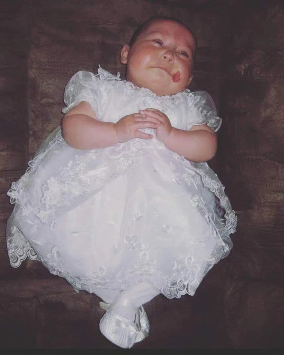 Milly was so not impressed! Her godmother rushed out to buy this gown for Milly's last min Baptism. If it wasn't for KB Milly would have been wearing an adapted white pillow case. 
You can see one of her hemangiomas growing on her face.
