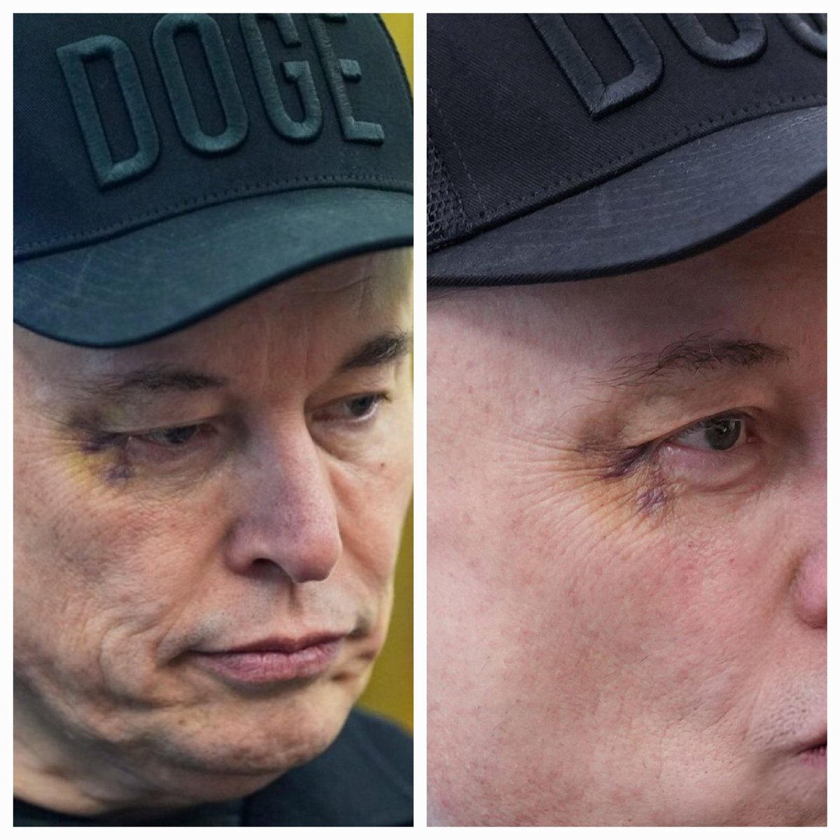 شوهد إيلون ماسك وهو يعاني من كدمة واضحة حول عينه اليسرى، مع تورم وتغير في لون الجلد أثناء تواجده في البيت الأبيض برفقة الرئيس ترامب.

قدّم له الرئيس ترامب مفتاح البيت الأبيض، واصفًا إياه بهدية من الأمة.

وسيستمر ماسك في دوره كمستشار للرئيس ترامب.