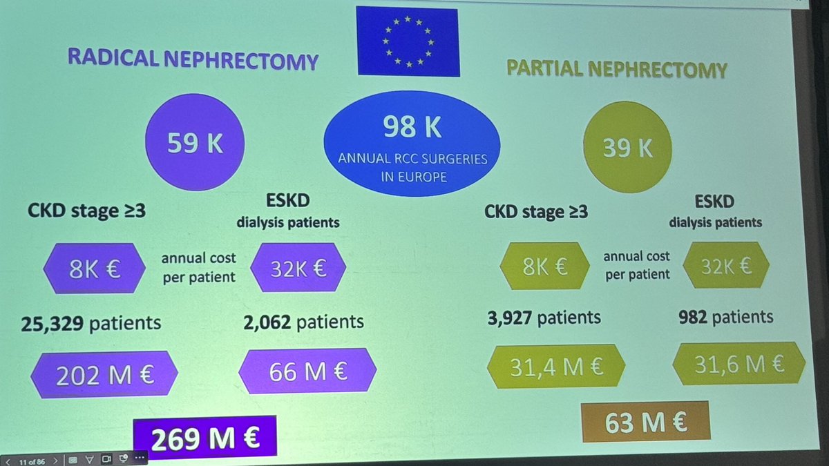 Wisit Cheungpasitporn MD FACP | FASN | FAST (@wisit661) on Twitter photo Excellent talk 🙂👏 By Dr. Francesco Trevisani (Milan, Italy) 🇮🇹 on “The management of renal function in patients undergoing nephrectomy”
Held at The 7th International Renal Meeting with Mayo Clinic in Sardinia
📍 Sa Manifattura, Cagliari | May 29–June 1, 2025 | <a href="/MayoClinicNeph/">Mayo Clinic Nephrology</a> Excellent talk 🙂👏 By Dr. Francesco Trevisani (Milan, Italy) 🇮🇹 on “The management of renal function in patients undergoing nephrectomy”
Held at The 7th International Renal Meeting with Mayo Clinic in Sardinia
📍 Sa Manifattura, Cagliari | May 29–June 1, 2025 | <a href="/MayoClinicNeph/">Mayo Clinic Nephrology</a>