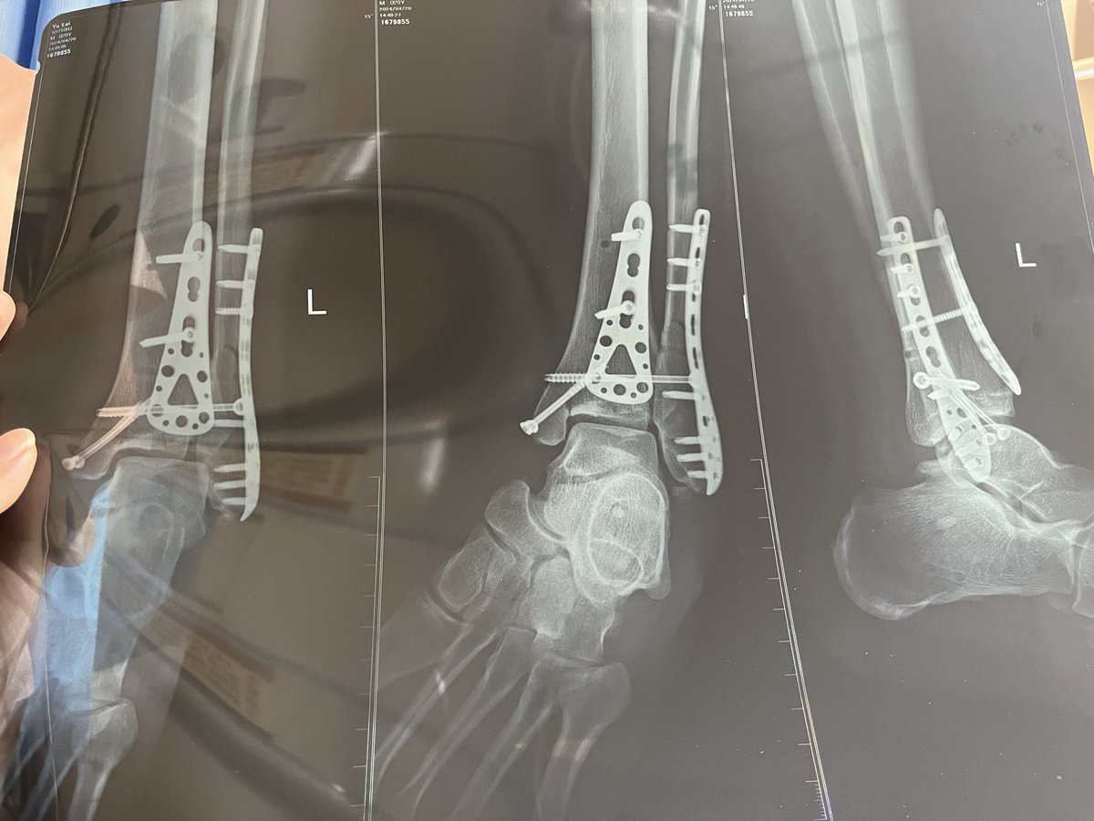 应该也许能暂告一段落了