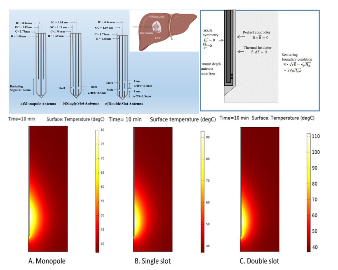 Effect of the antenna slot numbers and position on the performance of microwave ablation
sciencedirect.com/science/articl…
#MedTwitter #scicomm #MedEd #AcademicTwitter