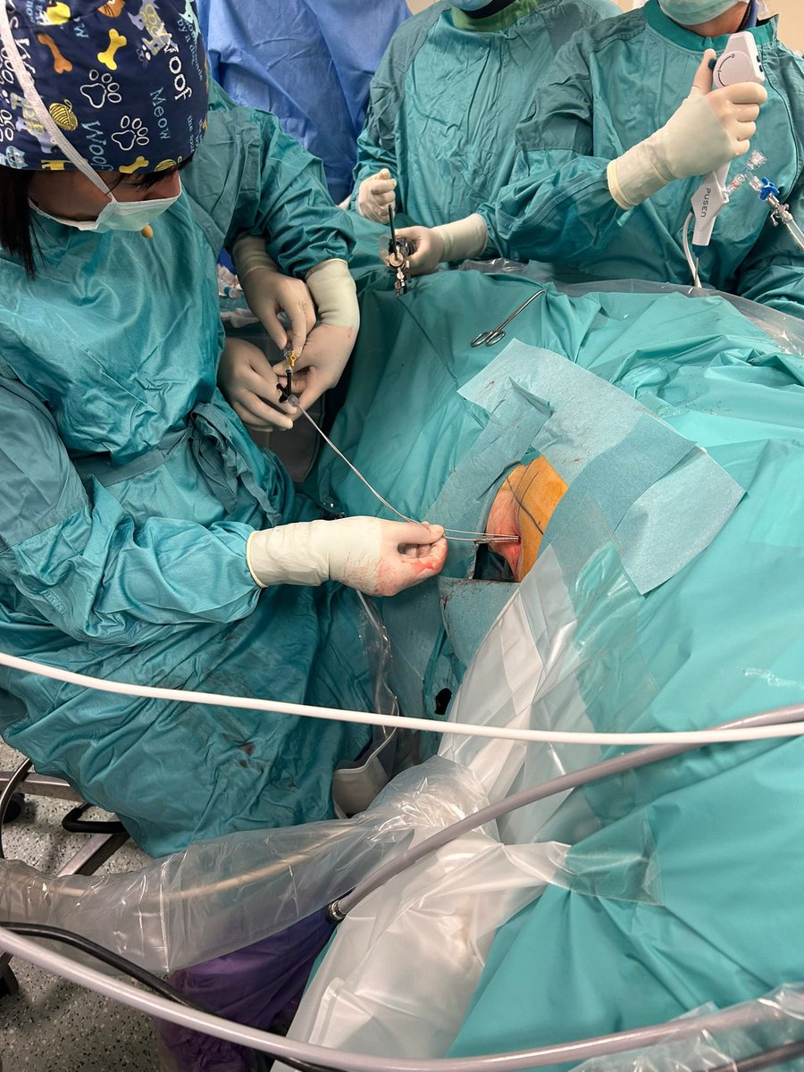 JoseSM (@jose_cookuro) on Twitter photo Fantastic team, Dr #AMSalerno <a href="/CraccoCecilia/">Cecilia Cracco</a> & <a href="/StefaniaFerret/">Stefania Ferretti</a> performing #ECIRS procedure during #IEA25 Congress in Rome. Congratulations.@cookies #cookuro Fantastic team, Dr #AMSalerno <a href="/CraccoCecilia/">Cecilia Cracco</a> & <a href="/StefaniaFerret/">Stefania Ferretti</a> performing #ECIRS procedure during #IEA25 Congress in Rome. Congratulations.@cookies #cookuro