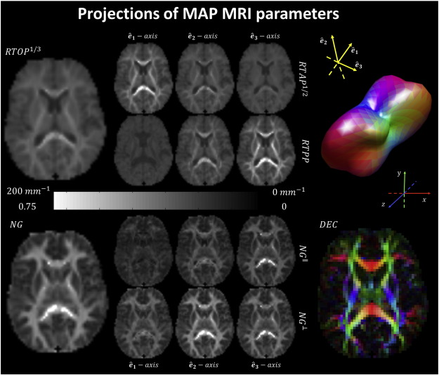 thmonk_pf's tweet photo. multishell dMRIから得られるDTI/NODDI/MAP-MRI(図はhttps://t.co/mX6JGjp5rlから)の組合せが高齢者認知機能予測で単独指標より優れる
海馬拡散指標は記憶機能を領域特異的に予測し前頭前野は作業記憶課題を予測する
容積測定を上回る予測精度
#NODDI
#MAP
#papers
https://t.co/SOfv3pK4QX https://t.co/08PenVIJbp