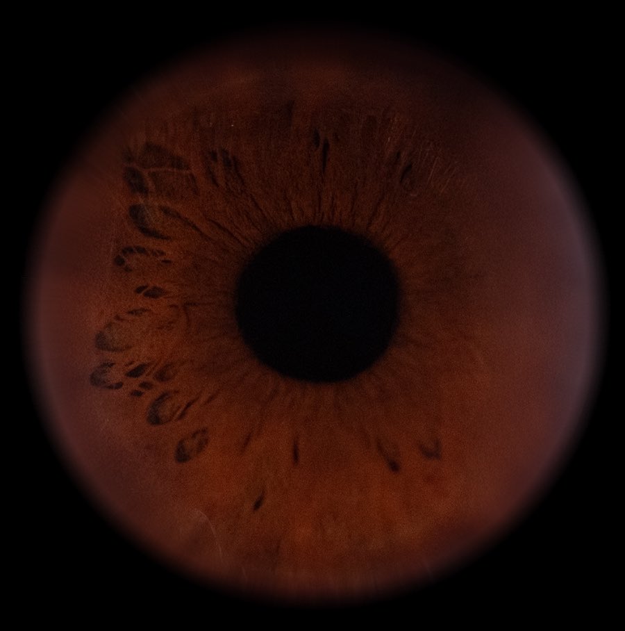the eye of art &amp; the eye of the artist