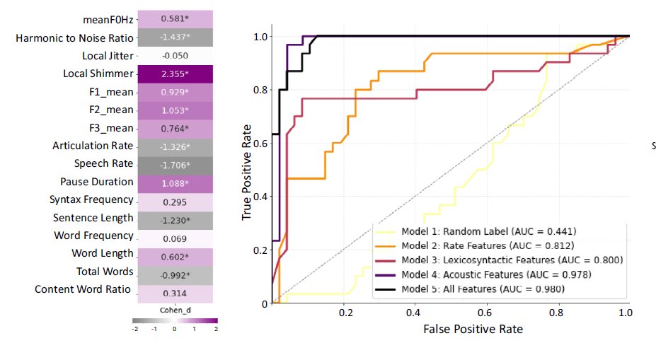 David L. Perez MD, MMSc, FAAN, FANPA (@davidlewisperez) on Twitter photo Can digital speech markers classify functional speech disorder vs healthy controls? Might digital features identify adjunctive rule in markers (i.e., local shimmer)? Check out <a href="/MDJ_Journal/">Movement Disorders Journal</a> Proof-of-Principle Pilot. <a href="/NeguineR/">Neguine Rezaii</a> #JenniferFreeburn <a href="/FNDSociety/">Functional Neurological Disorder Society</a>
…mentdisorders.onlinelibrary.wiley.com/doi/10.1002/md… Can digital speech markers classify functional speech disorder vs healthy controls? Might digital features identify adjunctive rule in markers (i.e., local shimmer)? Check out <a href="/MDJ_Journal/">Movement Disorders Journal</a> Proof-of-Principle Pilot. <a href="/NeguineR/">Neguine Rezaii</a> #JenniferFreeburn <a href="/FNDSociety/">Functional Neurological Disorder Society</a>
…mentdisorders.onlinelibrary.wiley.com/doi/10.1002/md…
