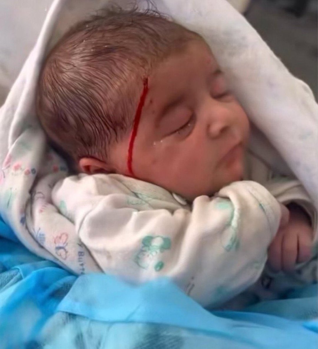 #ImmediateCeasefireforGaza