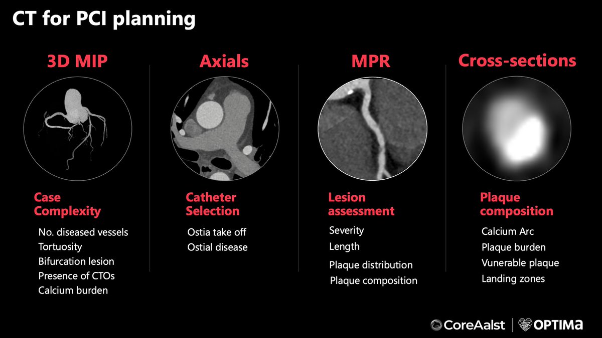 Carlos Collet MD PhD (@colletcarlos) on Twitter photo 🎯 Are you an interventional cardiologist?
👇This is Everything You Need to know about CT to guide PCI
📆 July 7–8. Whether you're starting with #CCTA or an expert, this course is for you.
🔥 Register now streaming and onsite: lnkd.in/eZXBNp2v
<a href="/PCRonline/">PCRonline 🫀</a> <a href="/OptimaCTO/">Optima Education</a> 🎯 Are you an interventional cardiologist?
👇This is Everything You Need to know about CT to guide PCI
📆 July 7–8. Whether you're starting with #CCTA or an expert, this course is for you.
🔥 Register now streaming and onsite: lnkd.in/eZXBNp2v
<a href="/PCRonline/">PCRonline đź«€</a> <a href="/OptimaCTO/">Optima Education</a>