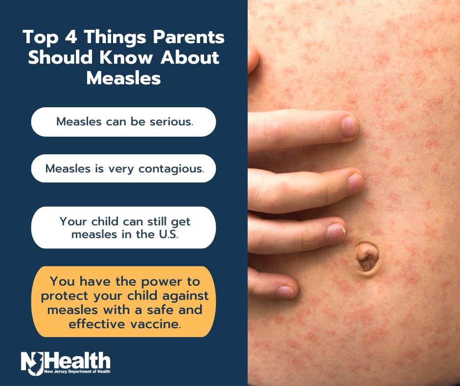 You can protect yourself from measles by getting vaccinated, washing your hands often, covering your coughs and sneezes, and by not sharing utensils, water bottles, and other items with those who are sick. Learn more: nj.gov/health/cd/meas… #HealthierNJ
