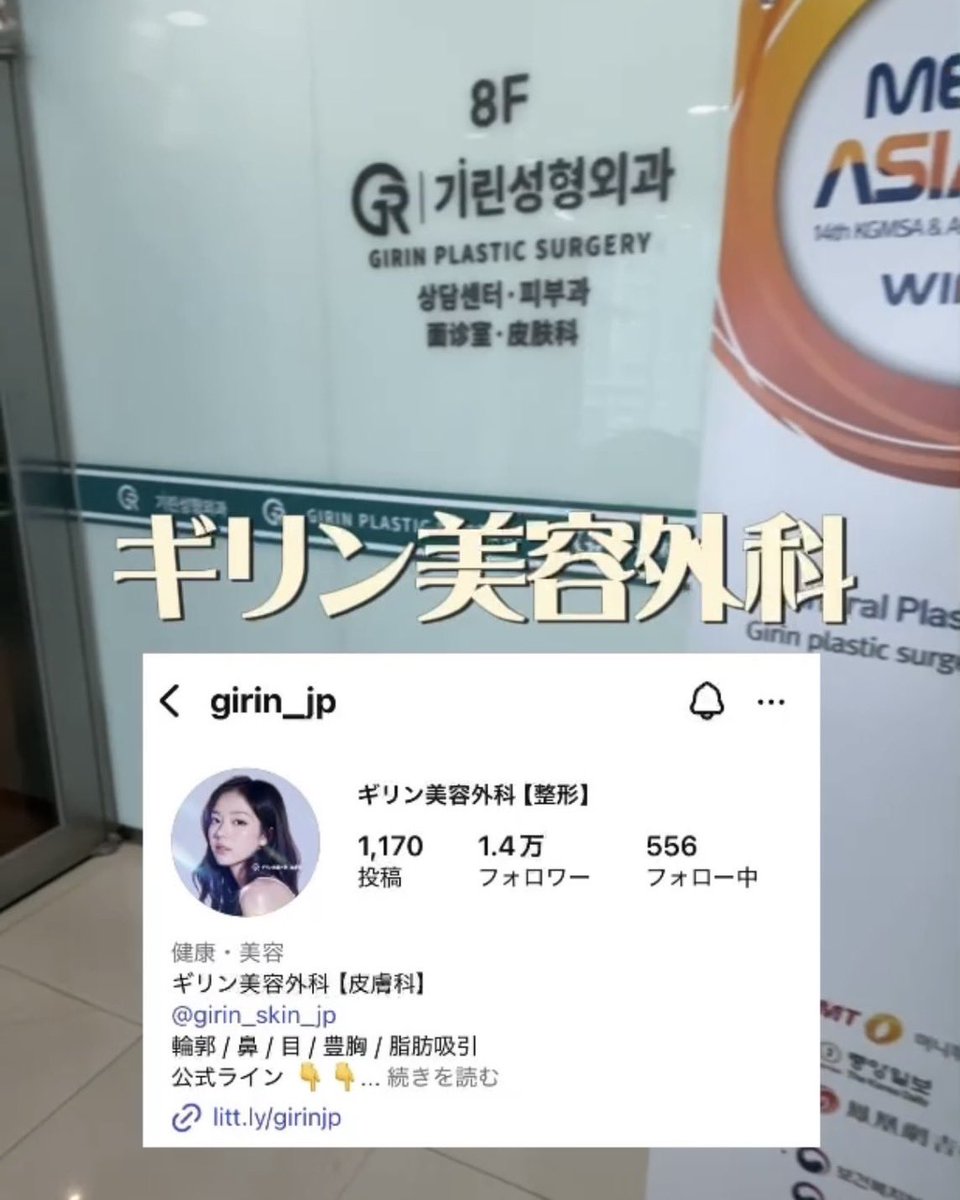 isoshi1015's tweet photo. 韓国のクリニックオリジナル
二の腕痩せ注射 ギャルム💉✨

結論、効果あり。パンパンの二の腕が柔らかくなり、注入部位のラインが真っ直ぐになってきた。
ダンスイベント前に受けてよかった!
1週間あざになるからスケジュールには余裕を持って🙌

ギリン美容外科
韓国 江南方面 新論峴駅すぐ
@girinjp https://t.co/k1xZX5IXsx