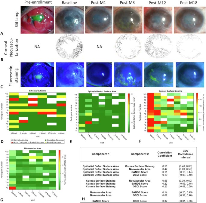 Ronita De, PhD (@dronita_de) on Twitter photo Revolutionary news in eye health!
A new stem cell therapy, CALEC, shows a stunning 92% success rate in regenerating corneas and restoring sight for patients with previously untreatable eye injuries.
nature.com/articles/s4146…
<a href="/_atanas_/">Atanas G. Atanasov</a> <a href="/_MCRicardo_/">🔬 RicardoMontes</a> #DHPSP Revolutionary news in eye health!
A new stem cell therapy, CALEC, shows a stunning 92% success rate in regenerating corneas and restoring sight for patients with previously untreatable eye injuries.
nature.com/articles/s4146…
<a href="/_atanas_/">Atanas G. Atanasov</a> <a href="/_MCRicardo_/">🔬 RicardoMontes</a> #DHPSP