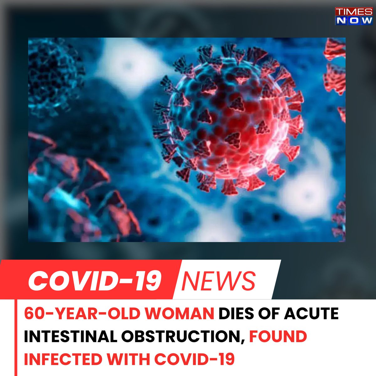 60-Year-Old Woman Dies Of Acute Intestinal Obstruction, Found Infected With Covid-19

#TNCards #CovidCases #DelhiCovidCases 

timesnownews.com/delhi/delhi-co…