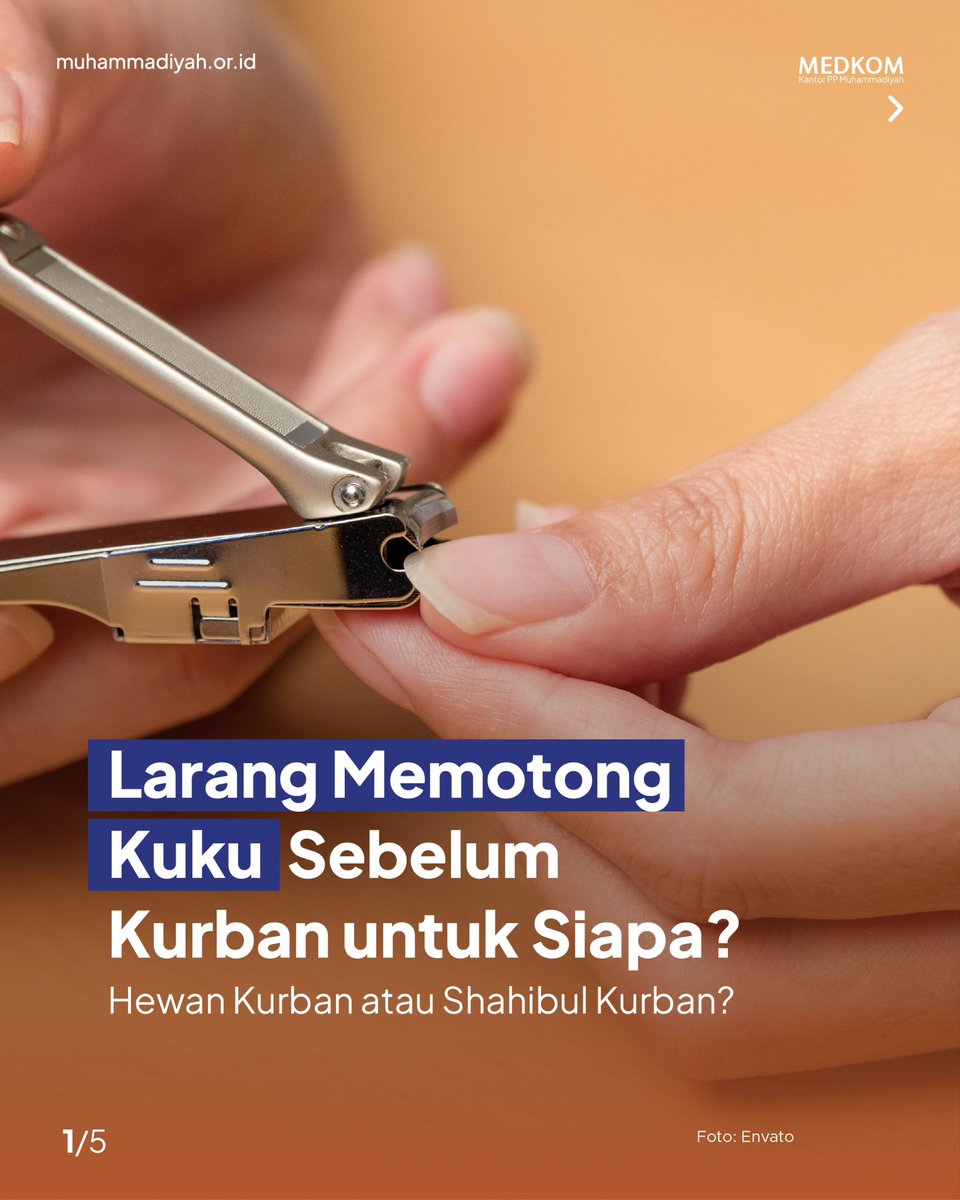 Dengan memahami aturan ini, semoga kita bisa menjalankan ibadah kurban dengan lebih sempurna dan khidmat, sesuai dengan tuntunan yang diajarkan oleh Nabi Muhammad SAW.

©️ Media dan Komunikasi Pimpinan Pusat Muhammadiyah

#Iduladha #Idulkurban #FikihKurban #Muhammadiyah