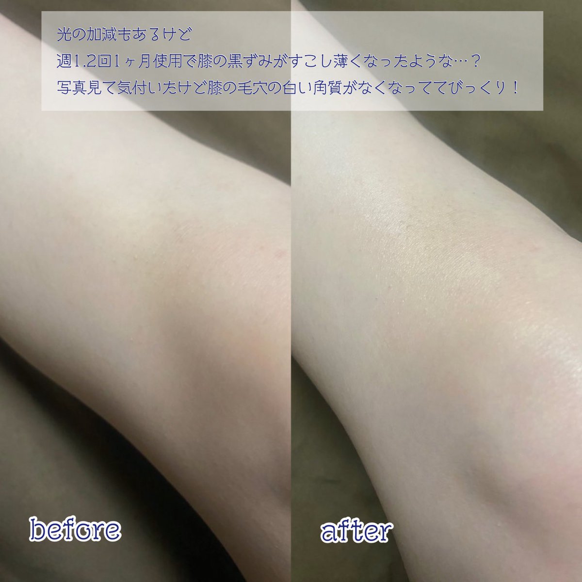 msrurak's tweet photo. ▼BnD マシュマロスクラブ

BnD様(@BnD_official_jp )より
お試しさせていただきました✨ #PR 

顔はもちろんデリケートゾーンや
背中など全身に使えるスクラブ！

スクラブはザラザラしてるのが多いけど
これはかなりクリーミーなテクスチャで
優しいので顔にも使いやすかった🦭✨

↓↓ https://t.co/g59Lvu3a5z