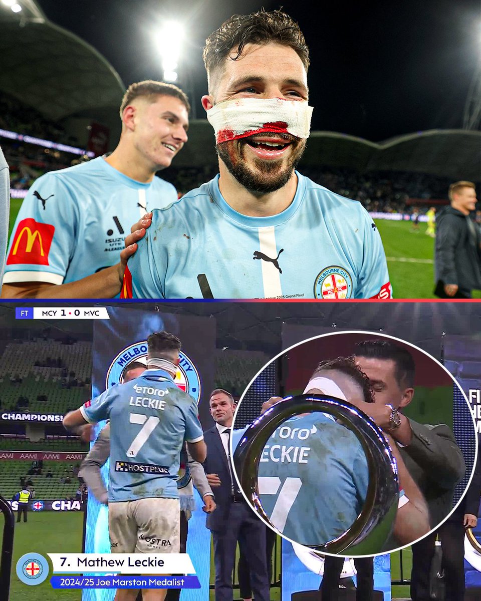 Mathew Leckie is your Joe Marston medallist 🏅 Best on ground in the Isuzu UTE A-League Grand Final.

What a warrior!

More details: tinyurl.com/5cj6ay4k

#MCYvMVC