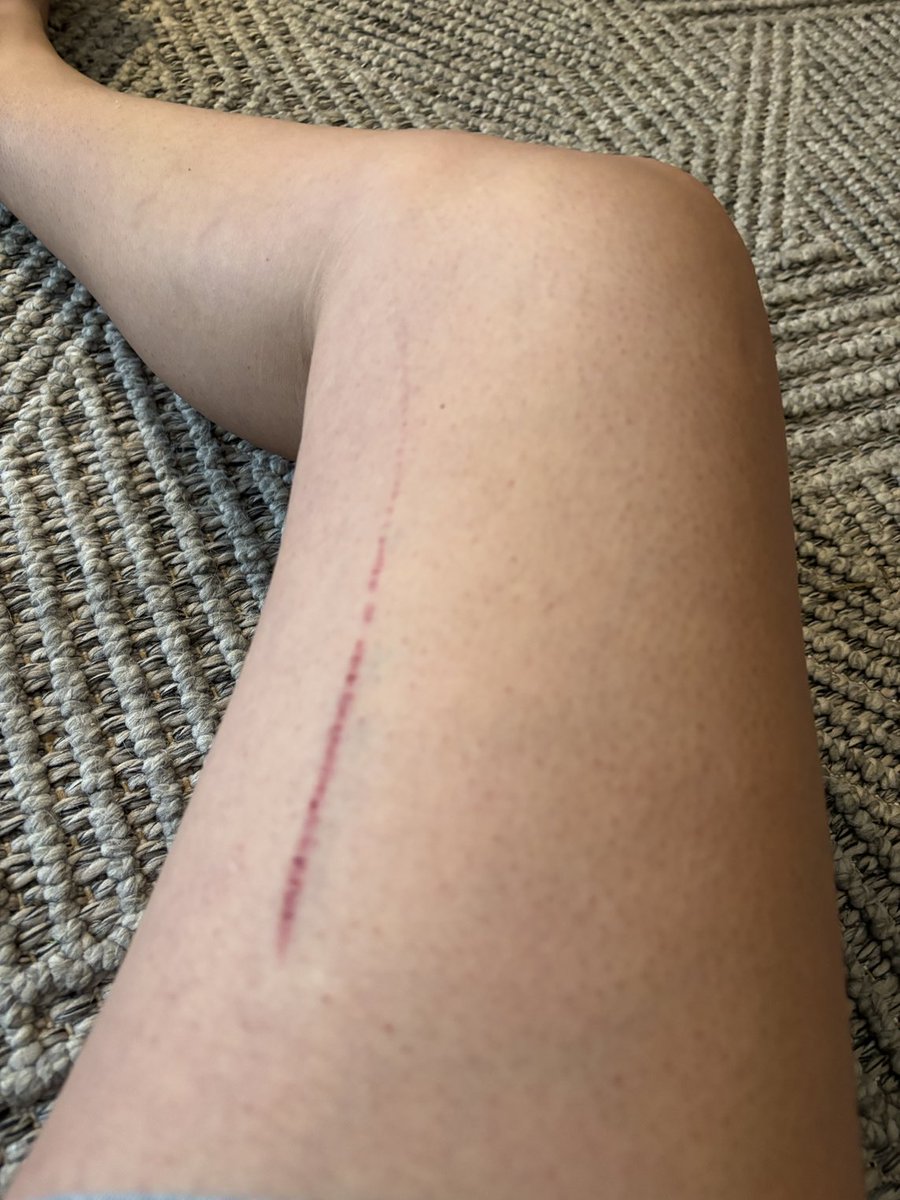 bigdav666's tweet photo. The dawg tore me up https://t.co/8P2RMqbTkV