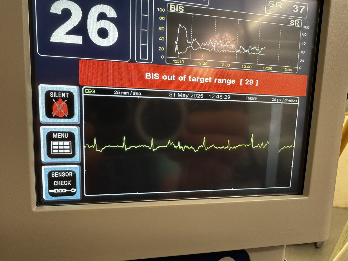 Processed EEG. What’s going on here?