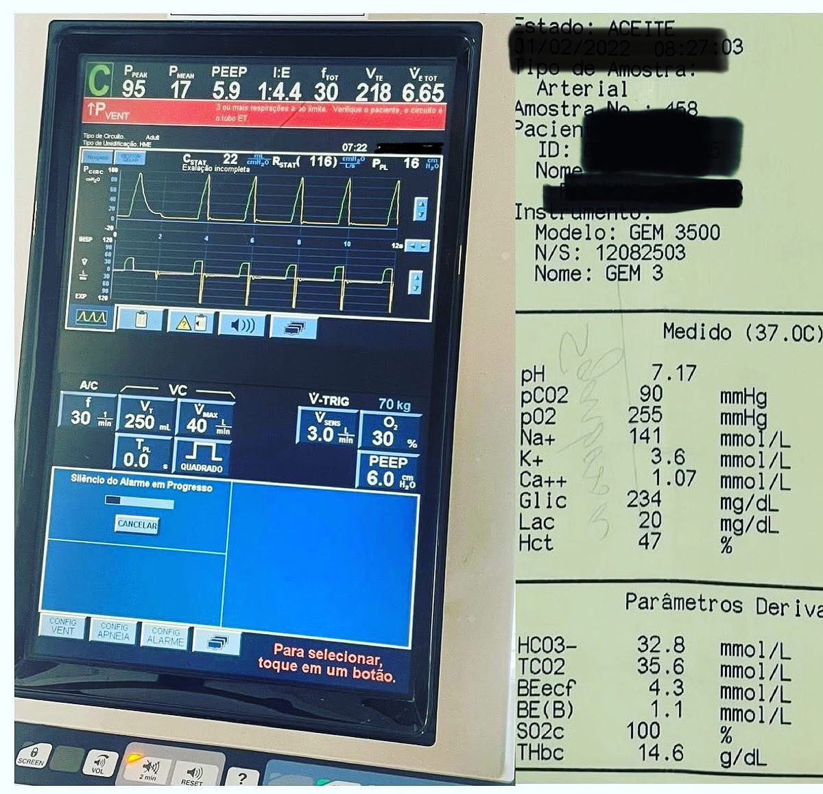 Angelo Roncalli (@curso_vm) on Twitter photo Who's afraid of peak pressure? <a href="/msiuba/">Matt Siuba</a> <a href="/ArielG_RRT/">Ariel J Garnero</a> <a href="/Thind888/">Aman Thind</a> <a href="/DrMiguelIbarra1/">Dr. Miguel Ibarra-Estrada</a> <a href="/OrlandoRPN/">Orlando R. Pérez-Nieto</a> <a href="/DocMusician/">Doc Musician</a> <a href="/GallodeMoraesMD/">Alice Gallo, MD</a> Who's afraid of peak pressure? <a href="/msiuba/">Matt Siuba</a> <a href="/ArielG_RRT/">Ariel J Garnero</a> <a href="/Thind888/">Aman Thind</a> <a href="/DrMiguelIbarra1/">Dr. Miguel Ibarra-Estrada</a> <a href="/OrlandoRPN/">Orlando R. Pérez-Nieto</a> <a href="/DocMusician/">Doc Musician</a> <a href="/GallodeMoraesMD/">Alice Gallo, MD</a>
