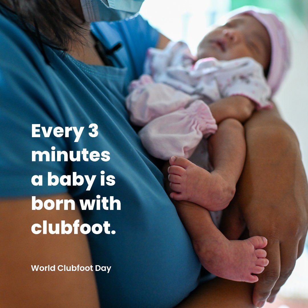 project_enhance's tweet photo. #WorldClubfootDay #clubfoot #MiracleFeet #WCD2025 #WCD #ClubfootAwareness #PonsetiMethod #clubfoottreatment #HealthEquity #GlobalHealth #ChildHealth
@NG_PLAN
@PLANFoundationNGO
@Plan Foundationng
@plan.foundationng
@PLANFoundationNG https://t.co/zuVgD4yyDT