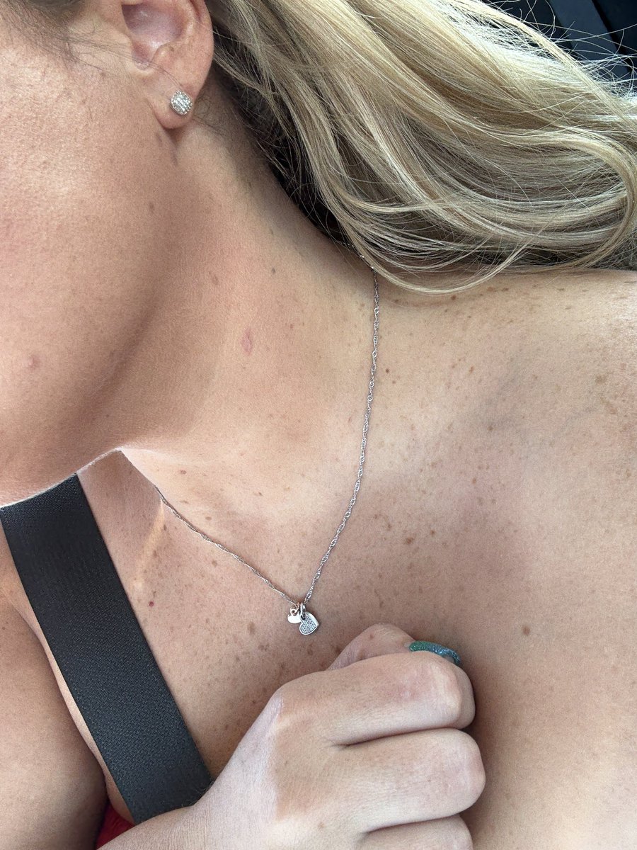 Do you think folks will believe me when I say I burnt myself on my curling wand?