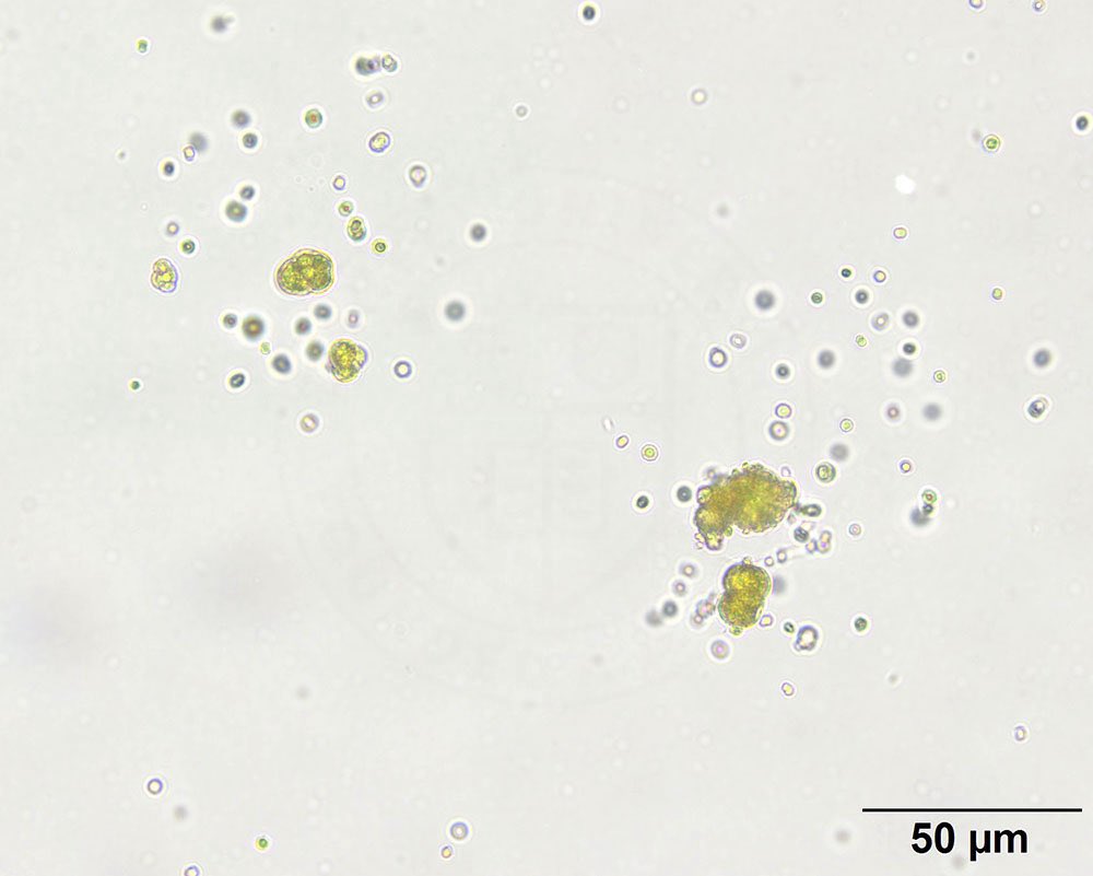 Xanthine crystals in urine from two dogs on allopurinol therapy. The crystals can be misidentified as ammonium biurate but they are insoluble in hydrochloric acid (HCl) and sodium hydroxide (NaOH, &lt; 1N). Ammonium biurate are soluble in HCl and NaOH.