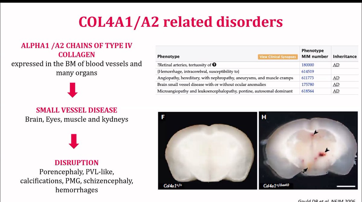 Jordi Roldan (@jordiroldanb) on Twitter photo International Pediatric Neuroradiology Teaching Network
Season VI: Eternal Debates
Chapter III: Neuroradiologists should always try and predict the genes in their reports!”
<a href="/The_ASPNR/">American Society of Pediatric Neuroradiology</a> <a href="/spinacademics/">SPIN | Society of Pediatric Neuroimaging</a>
Ready to learn. First things first: fetal imaging
🔝 <a href="/MSavinaSeverino/">Mariasavina Severino</a> International Pediatric Neuroradiology Teaching Network
Season VI: Eternal Debates
Chapter III: Neuroradiologists should always try and predict the genes in their reports!”
<a href="/The_ASPNR/">American Society of Pediatric Neuroradiology</a> <a href="/spinacademics/">SPIN | Society of Pediatric Neuroimaging</a>
Ready to learn. First things first: fetal imaging
🔝 <a href="/MSavinaSeverino/">Mariasavina Severino</a>