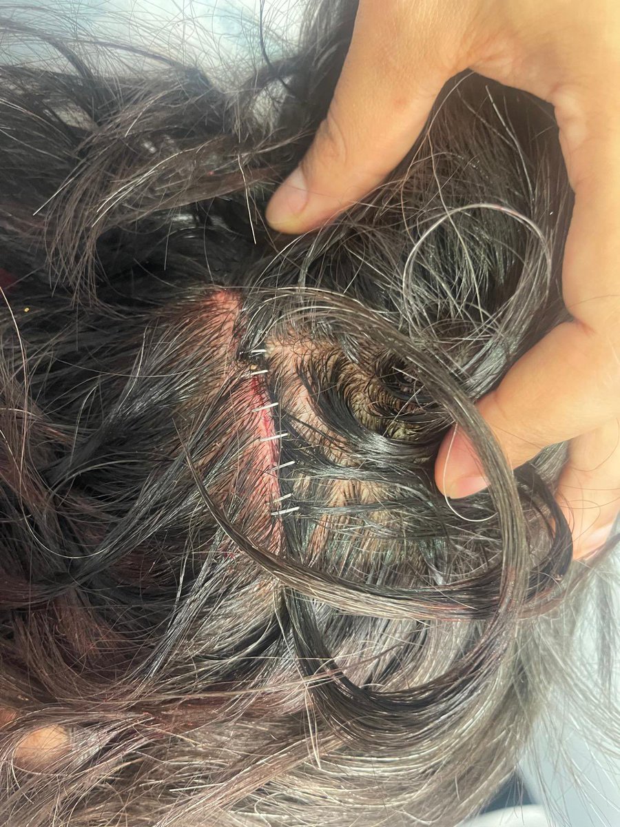 from_doris's tweet photo. Just brought Mrs D back from A&amp;E. For bugger. https://t.co/LVQajkRao9