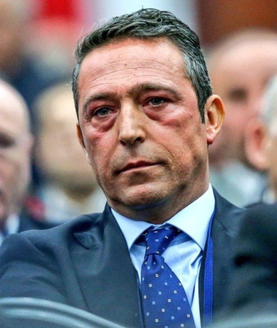 PSG kupayı aldığına göre daha yüksek sesle
 A L İ  K O Ç   İ S T İ F A  !