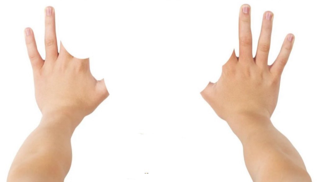 ho chiesto a ciro quanti ne avesse segnati il psg stasera