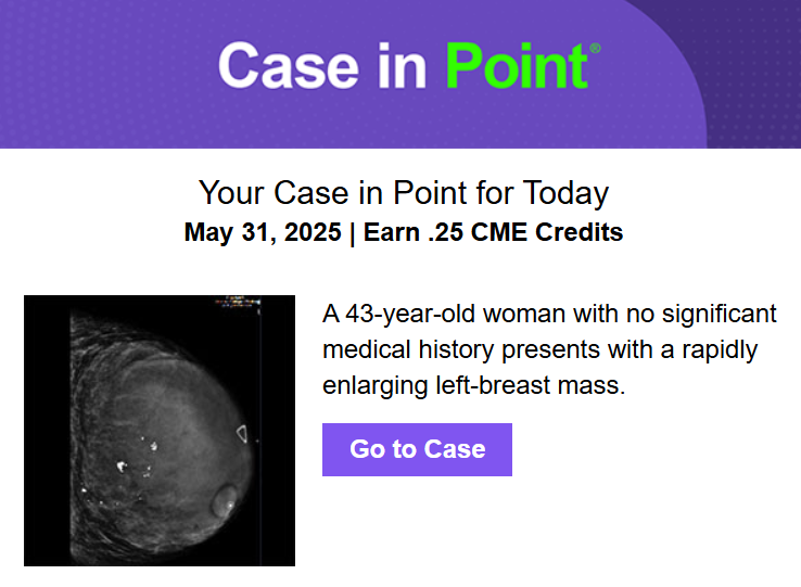 Join Y. Luh, MD (he/him/dude/他) (@j_luh) on Twitter photo Today's <a href="/RadiologyACR/">American College of Radiology</a> #CaseInPoint covers imaging findings of 2 types of tumors relevant to #radonc, courtesy of <a href="/emoryrad_save/">EmoryRadiology</a>
#bcsm #radoncres #oncologyresidents <a href="/d_golden/">Dan Golden MD MHPE</a> <a href="/jryckman3/">Jeff Ryckman</a>
cortex.acr.org/CiP/Pages/Case… Today's <a href="/RadiologyACR/">American College of Radiology</a> #CaseInPoint covers imaging findings of 2 types of tumors relevant to #radonc, courtesy of <a href="/emoryrad_save/">EmoryRadiology</a>
#bcsm #radoncres #oncologyresidents <a href="/d_golden/">Dan Golden MD MHPE</a> <a href="/jryckman3/">Jeff Ryckman</a>
cortex.acr.org/CiP/Pages/Case…