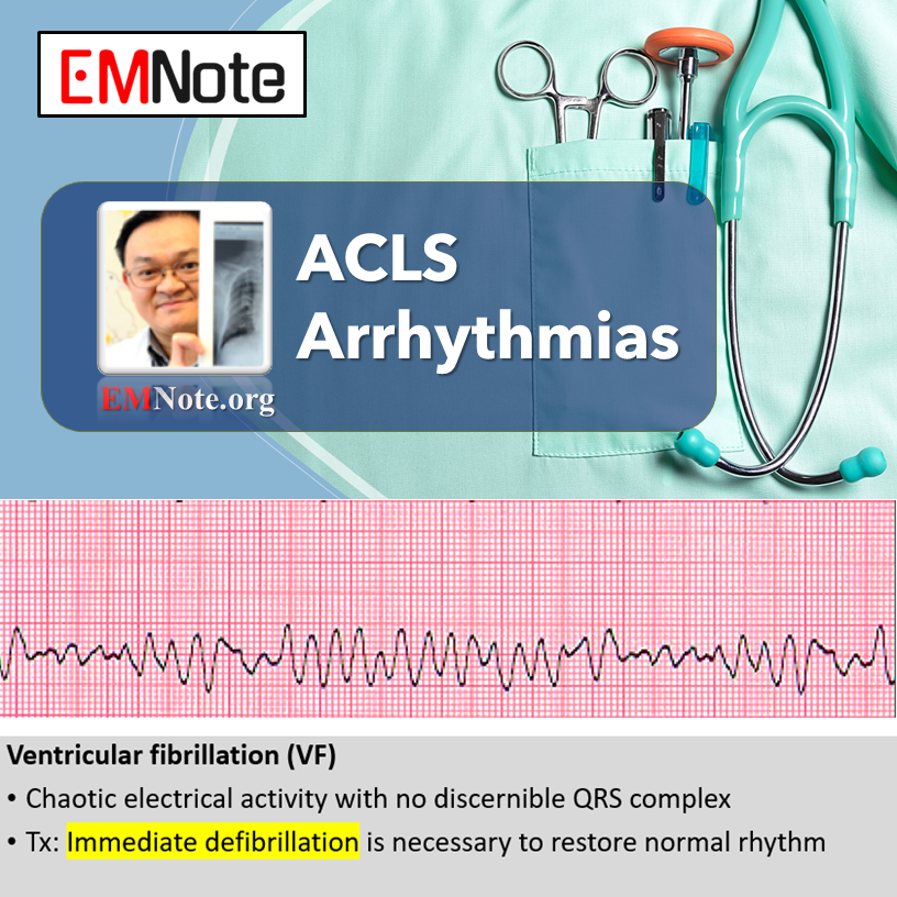 Free Online ACLS Training Course.
youtube.com/watch?v=uYX5S7…