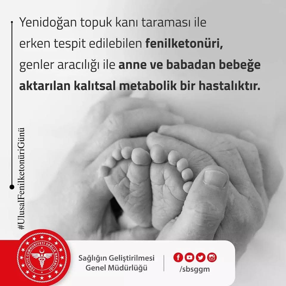 Yenidoğan topuk kanı taraması ile erken tespit edilebilen fenilketonüri, genler aracılığı ile anne ve babadan bebeğe aktarılan kalıtsal metabolik bir hastalıktır. 

#Ulusal FenilketonüriGünü

<a href="/sbsggm/">Sağlığın Geliştirilmesi</a> 
<a href="/saglikbakanligi/">T.C. Sağlık Bakanlığı</a>