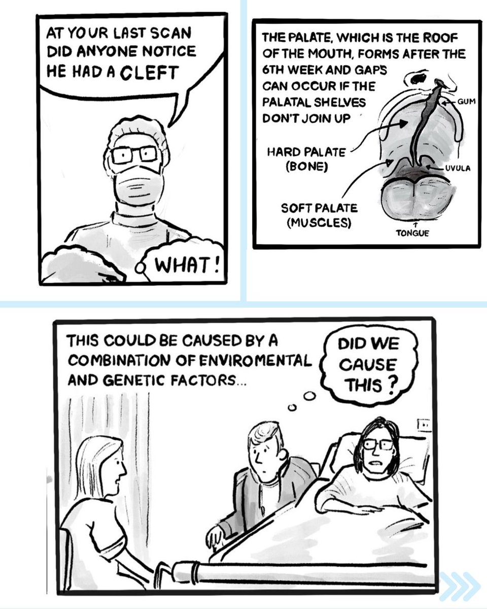 During Cleft Lip and Palate Awareness Week last month, the cleft community raised awareness in so many unique ways, including cartoonist Andrew.
 
Andrew's son was born with a cleft lip and palate which was diagnosed at birth.
 
[1/2]