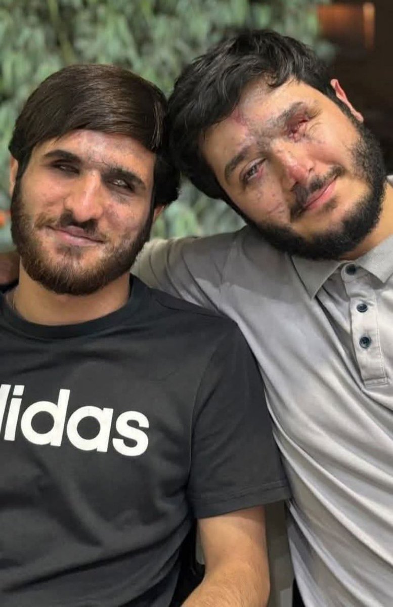 از حزب الله بعد ماجرای پیجر فقط یه باجناقی قدیمی موند.