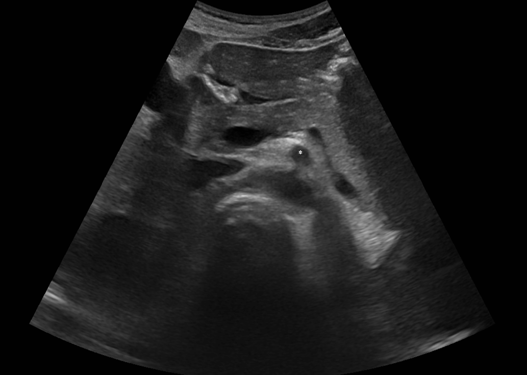 🔍 ¿Qué corte es y cuál es la estructura que se indica? 🔍

#pocus #ecosemfyc #formacionsemfyc