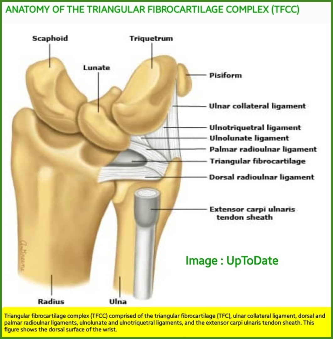 🛑TFCC anatomy beautifully shown in the image of dorsal surface of the wrist👍TFCC performs several important functions in the wrist,which the most important one is to stabilize the distal radioulnar joint. Also the discus component(TFC) helps to absorb compressive forces,.. etc