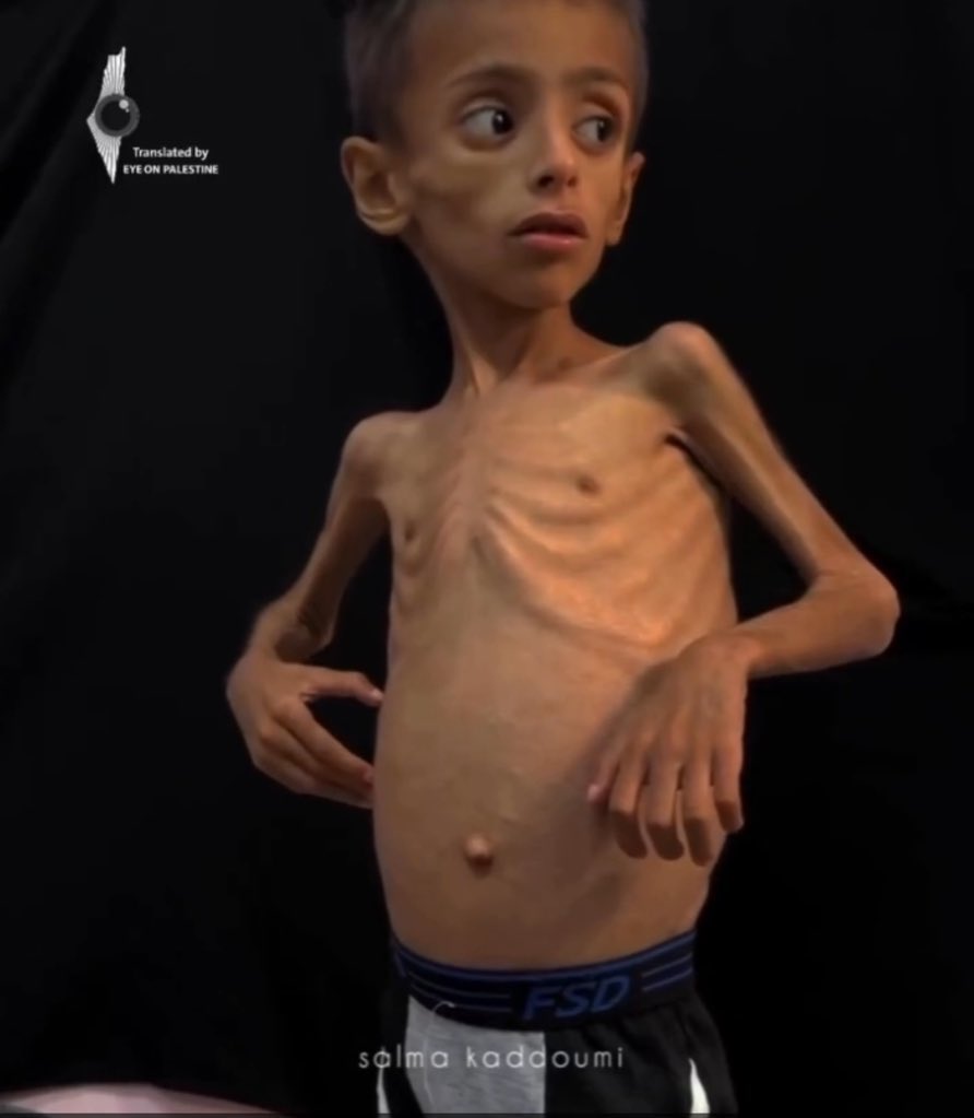 If you see this pic, reply with 💔🇵🇸 spread it.
He is starving 💔