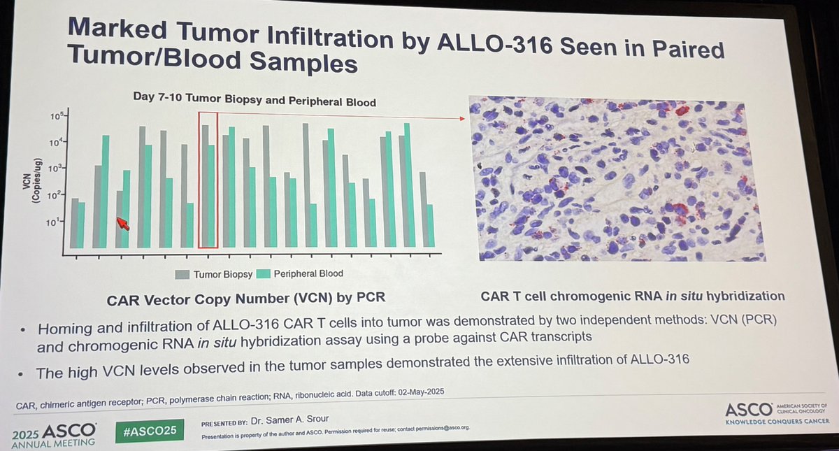 🗣️Kidney Cancer Oral Abstracts #ASCO25

👉Abs4508: Dr #SamerSrour presenting #ALLO316 (🎯anti-CD70 CAR-T) in refractory ccRCC #TRAVERSE 

n = 44
median of 3 prior therapies (1-8)
CD70 positive ccRCC = 36/44 (82%)
⏲️ median f/u = 6.8 mo (0.8-39.5)

💉(LD) w/ fludara + cyclop ±