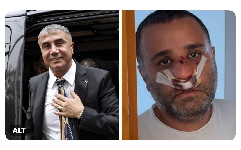 REİSİMİZ Marmaray'da İki Çocuğuyla Saldırıya Uğrayan Babaya, Rahat Seyahat Edebilmeleri İçin Araç Alınma Maksadıyla  2,5 Milyon TL Yardımda Bulundu.

 “Bu Dünyada İlâhi Adalete Mutlaka İnanmak Gerekir; Kim Haksız Yere Can Yakarsa Onun Canı da Mutlaka Yanar.”

@Sedat_Peker 👑