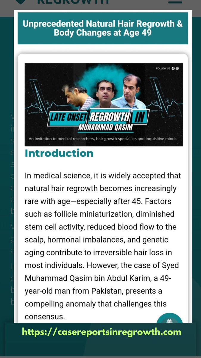 <a href="/Muhd_Qasim_PK/">Muhammad Qasim PK</a> The notion of natural height increase at 49 is considered, by all known scientific standards, biologically impossible. #QasimTransformation
#MuhammadQasim #HairGrowthMiracle