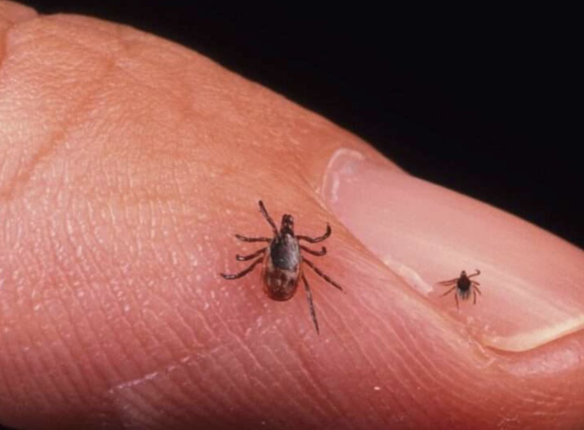 Garrapatas en la Meseta Norte peninsular. Resumen 👇 
youtu.be/FABCZ8ZIPqI

#klinikabildo, #mir2026 #examenmir, #estudia_medicina