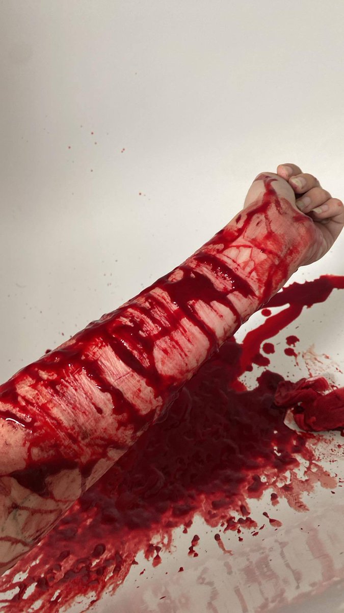 BPDfckingpanda's tweet photo. I cut even more after taking the picture, but then blood spurted and there was no time to take the picture lol https://t.co/tT7AcU3zep