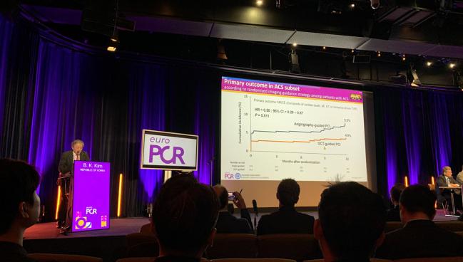 TCTMD (@tctmd) on Twitter photo Subanalysis of the OCCUPI trial reveals that patients with ACS and complex lesions have better outcomes when OCT is used to guide PCI rather than angiography. For more on the data presented at #EuroPCR2025: bit.ly/43yFmwK <a href="/Aspirinbk/">Byeong Keuk Kim</a> <a href="/RaberLorenz/">Lorenz Räber, MD PhD</a> <a href="/CuissetDr/">DrThomasCuisset</a> Subanalysis of the OCCUPI trial reveals that patients with ACS and complex lesions have better outcomes when OCT is used to guide PCI rather than angiography. For more on the data presented at #EuroPCR2025: bit.ly/43yFmwK <a href="/Aspirinbk/">Byeong Keuk Kim</a> <a href="/RaberLorenz/">Lorenz Räber, MD PhD</a> <a href="/CuissetDr/">DrThomasCuisset</a>