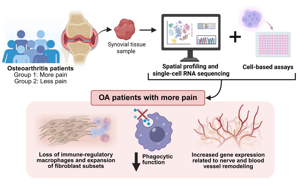 June A&amp;R Clinical Connections
⭐ Changes in Descending Pain Modulation During Anti-TNF Therapy in RA and SpA
⭐ Association of Synovial Innate Immune Exhaustion With Worse Pain in Knee OA
acr.tw/4mALq0x