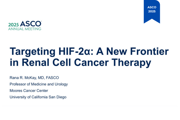 Oncobites.tv (@oncobitestv) on Twitter photo 🧪 #ASCO25 | Inhibición de HIF-2α en cáncer renal
La Dra. <a href="/DrRanaMcKay/">Rana McKay, MD, FASCO</a> presentó avances clave en CCR, incluyendo LITESPARK y nuevos datos sobre casdatifan.
💡 ¿Un nuevo horizonte terapéutico en tumores renales?
📲 Accede al análisis completo 👉 bit.ly/44YStK1 🧪 #ASCO25 | Inhibición de HIF-2α en cáncer renal
La Dra. <a href="/DrRanaMcKay/">Rana McKay, MD, FASCO</a> presentó avances clave en CCR, incluyendo LITESPARK y nuevos datos sobre casdatifan.
💡 ¿Un nuevo horizonte terapéutico en tumores renales?
📲 Accede al análisis completo 👉 bit.ly/44YStK1